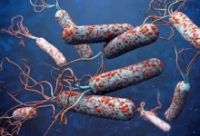 Plateau cholera outbreak