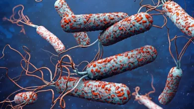 Plateau cholera outbreak