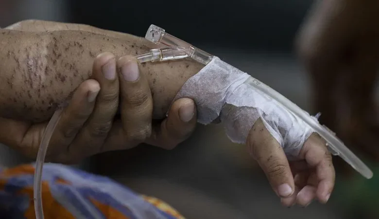 Bangladesh measles outbreak