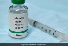 measles in children