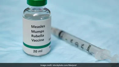 measles in children